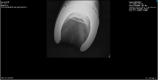 Left Forenavicular PAPR PADIO